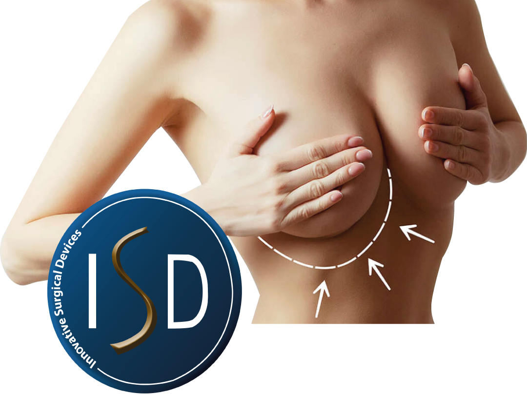 isd implantes